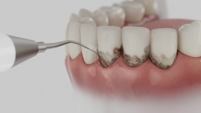 Reliable Emergency Dentist contractor in Newton, MS by Smile Center Dentistry